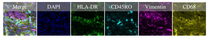 Interpolate start reference image.